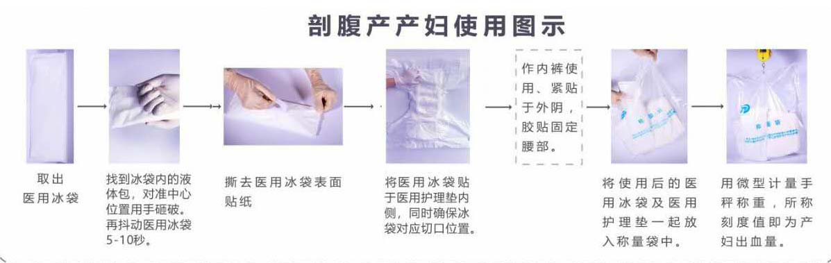 剖腹產